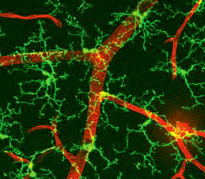 microglial cells at work